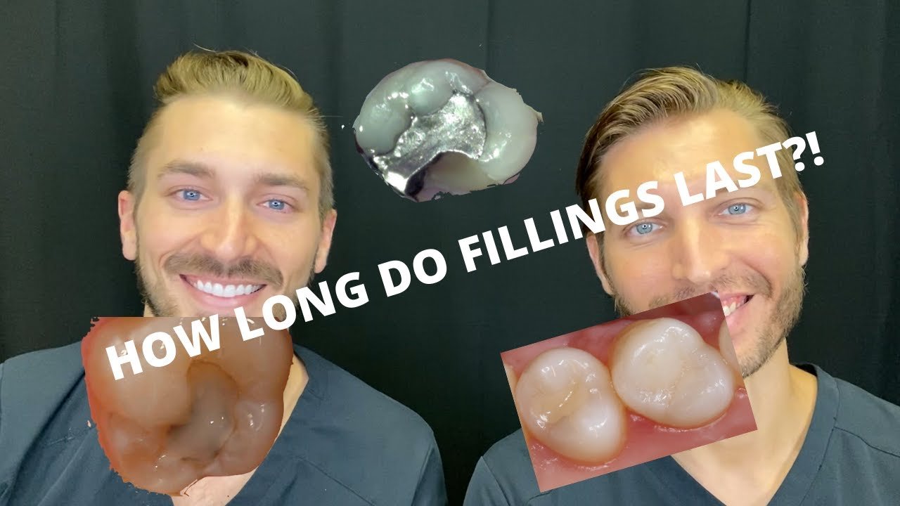 Discover How Long Does Getting A Filling Take